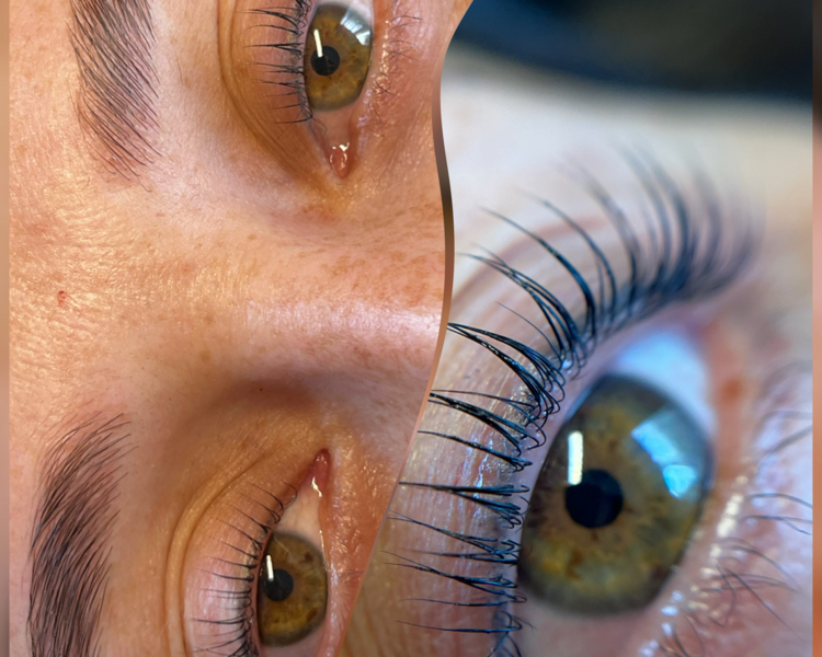 Lifting de pestañas 