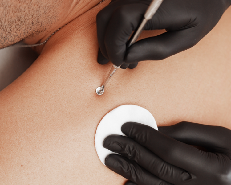 Limpieza de Espalda Profunda