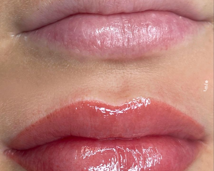 Baby  Lips (Micropigmentacios de labios )