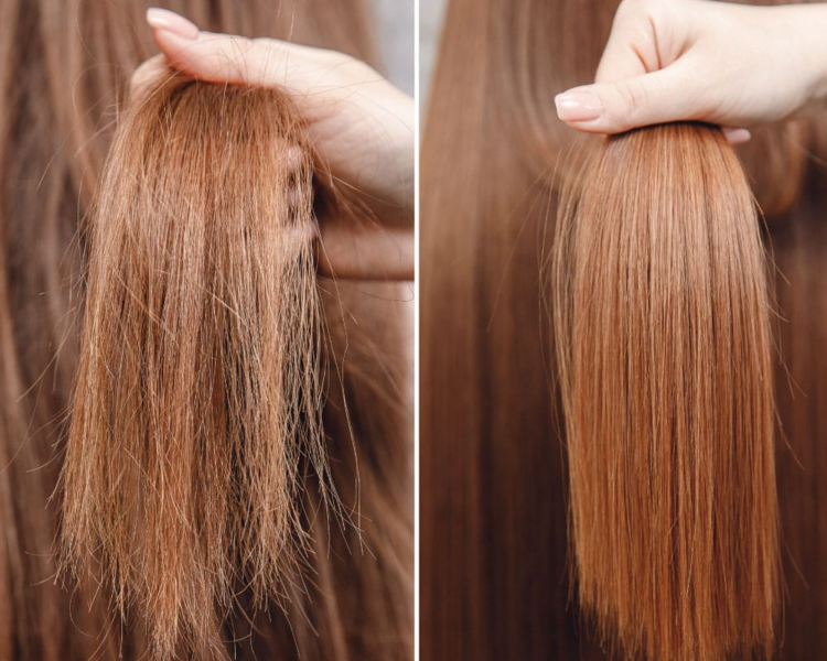 Bomba de hidratación