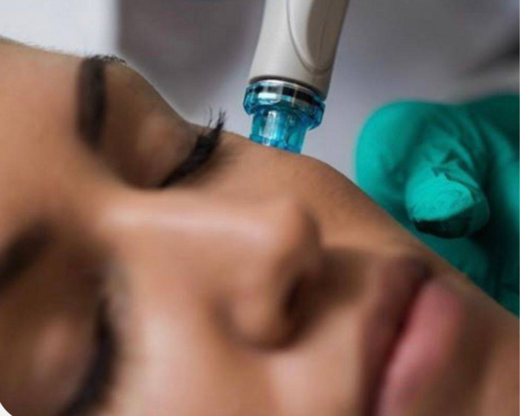 SESIÓN PRO AGE ( MICRONEEDLING )