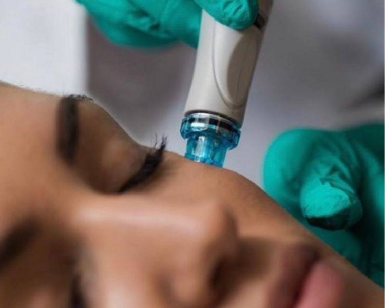 SESIÓN PREMIUM GLOW ( DERMAPLANING + MICRONEEDLING )