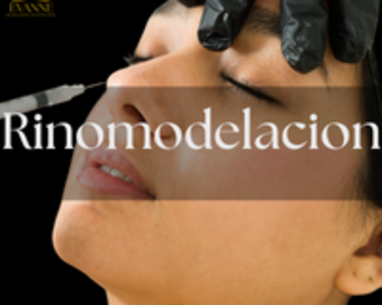 Nariz (Rinomodelación)