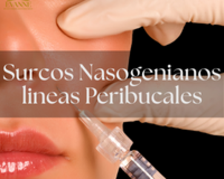 Surcos nasogenianos - Líneas peribucales