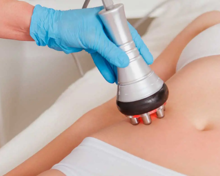 Tratamiento Reductivo Piernas 15 Sesiones