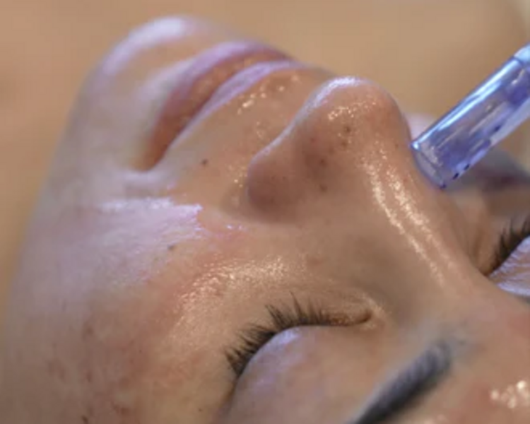 PDRN de Salmon regenerador PROMO