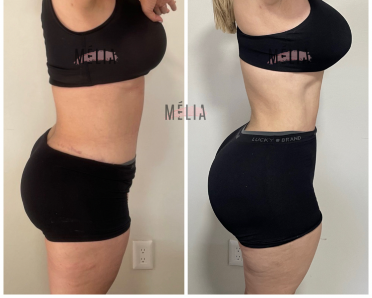 POST OP Tratamiento postoperatorio 