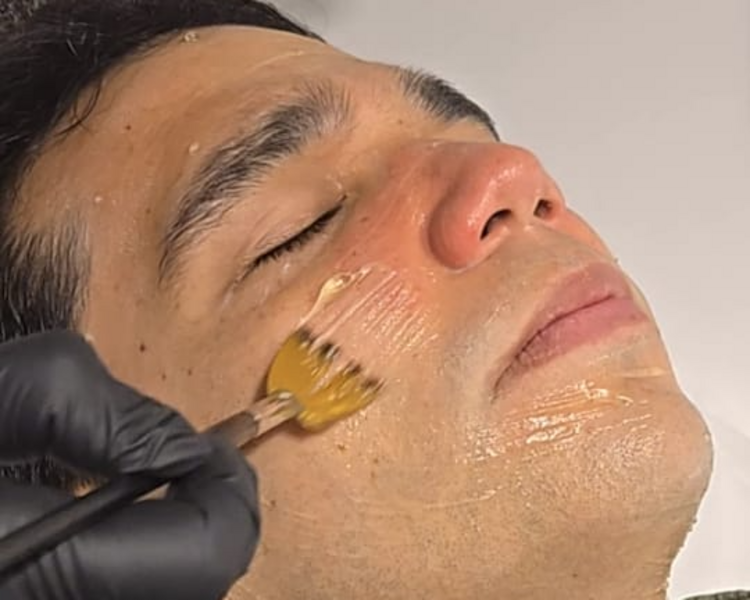 Limpieza Facial Profunda