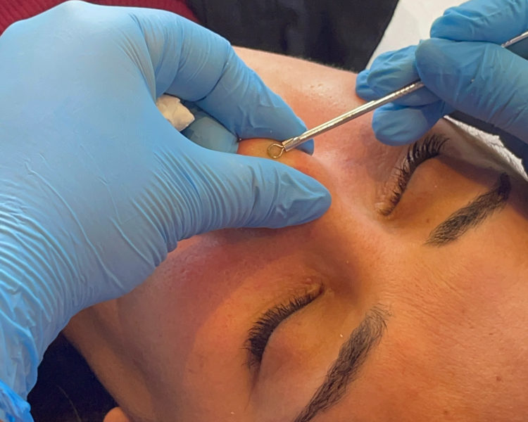 Limpieza facial profunda