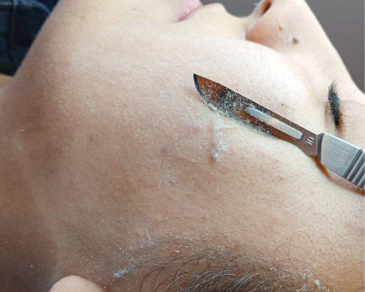 Dermaplaning + Limpieza facial profunda