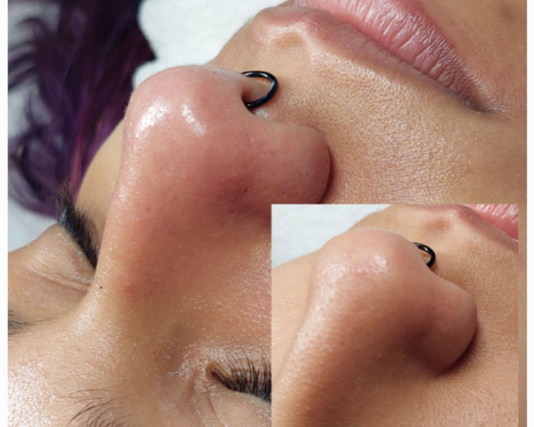 Higiene facial profunda  / con Gabi