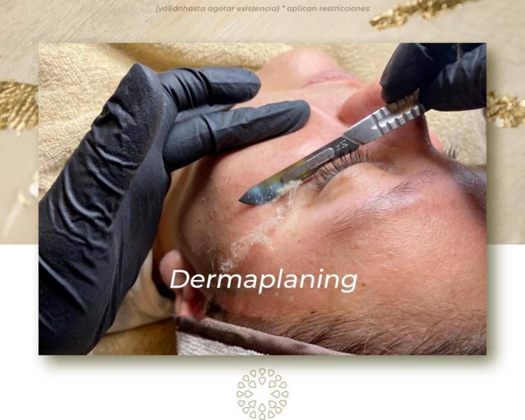 Dermaplaning