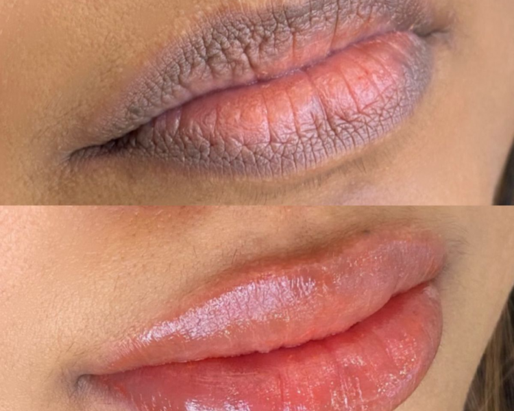 Micropigmentación de labios