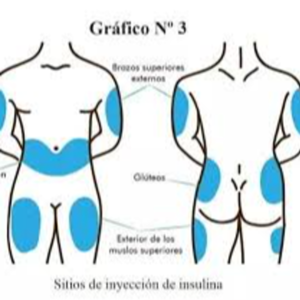 Inyección + Insumos 1 