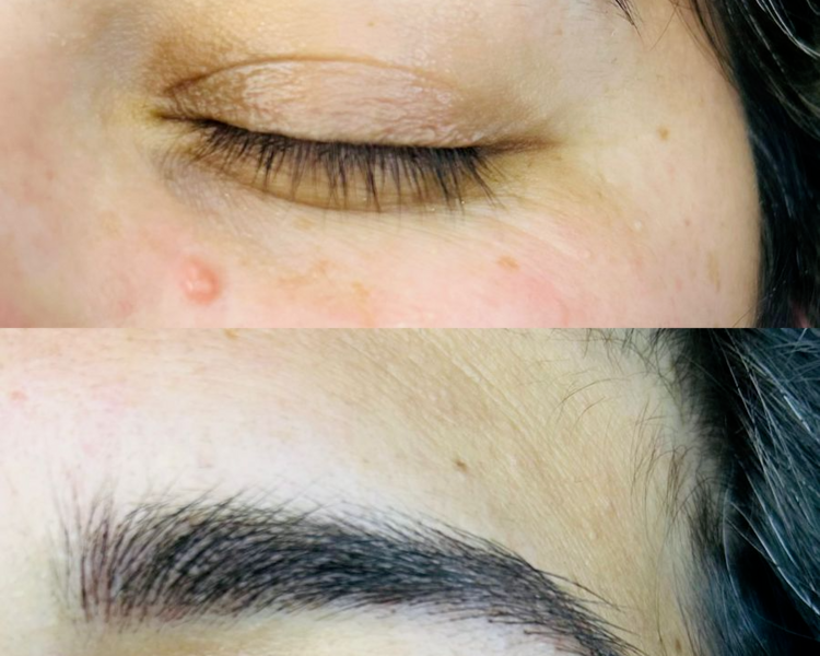 Microblading