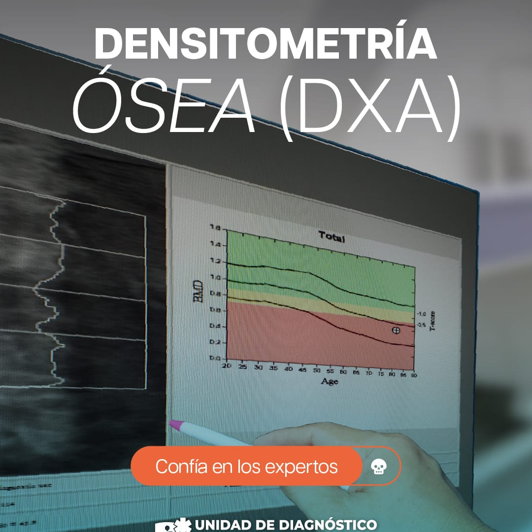 DENSITOMETRÍA ÓSEA