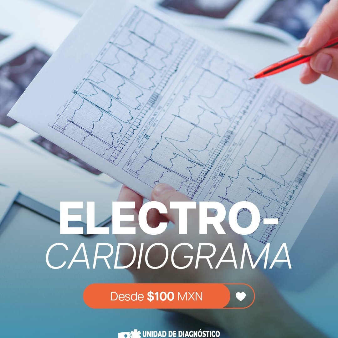 ELECTROCARDIOGRAMA