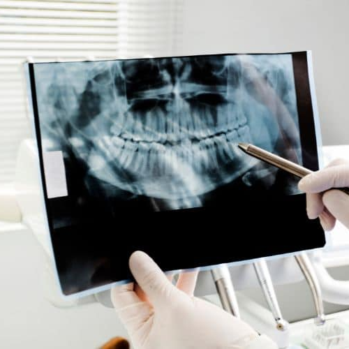 RAYOS X DENTALES