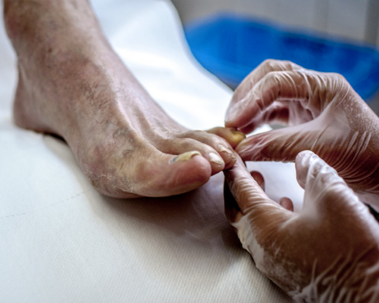 Podología Clinica Avanzada