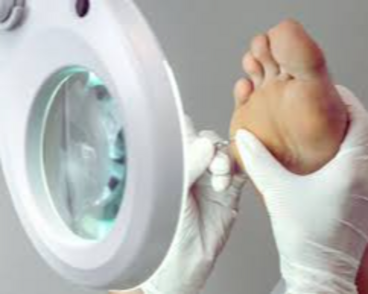 Tratamiento de Verrugas Plantares (valor por verruga)