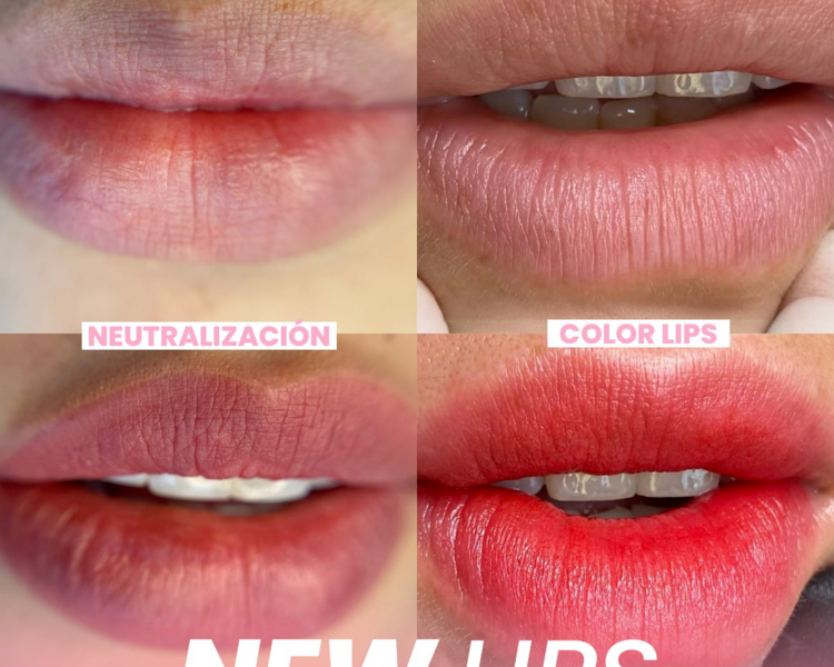 MICROPGMENTACION DE LABIOS 