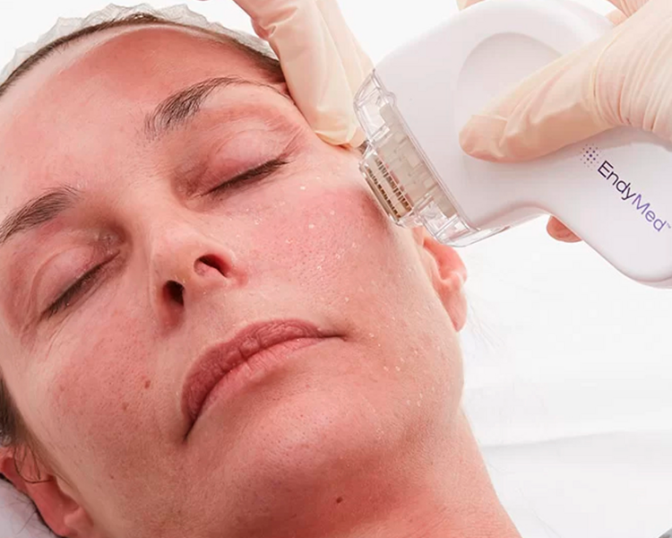 CABEZAL FSR 3 SESIONES 