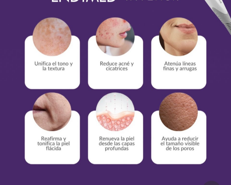 RADIOFRECUENCIA FRACCIONADA  3 SESIONES CABEZAL INTENSIF + FSR