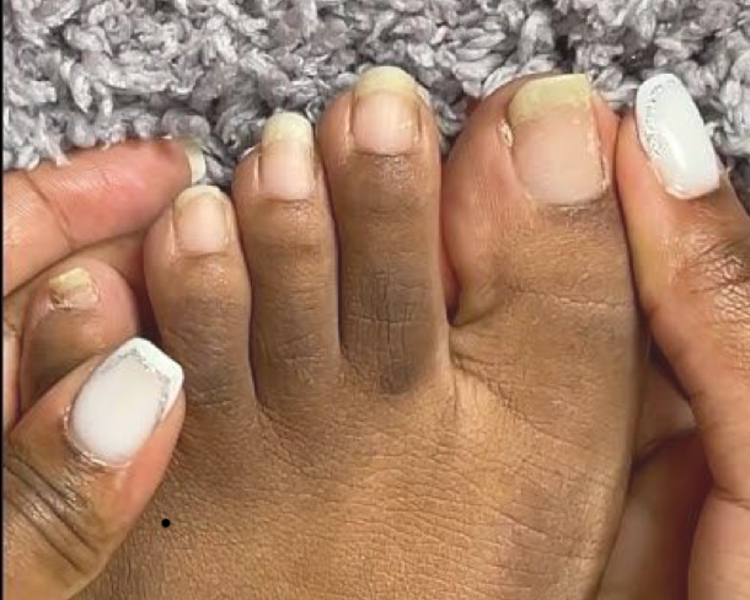 Retiro de Esmalte Semipermanente en pies  incluye corte y limado de uñas 