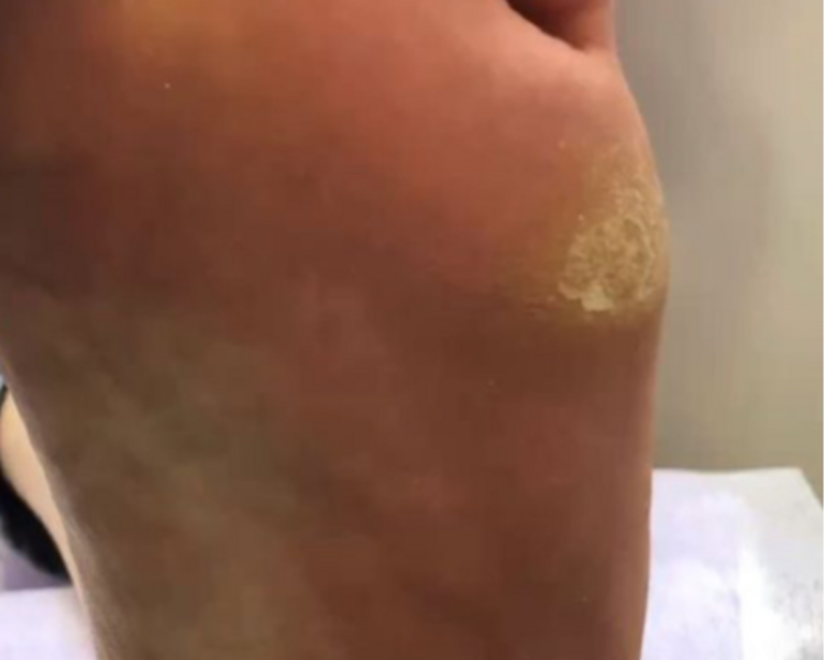 Podología sin Esmaltado (Hombre)