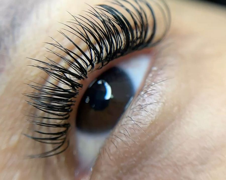 Extensiones clásicas