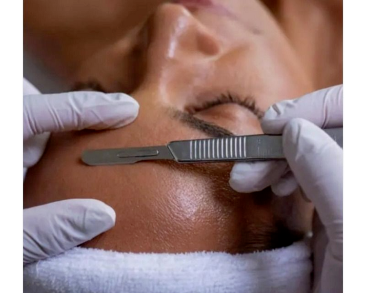 Dermaplaning