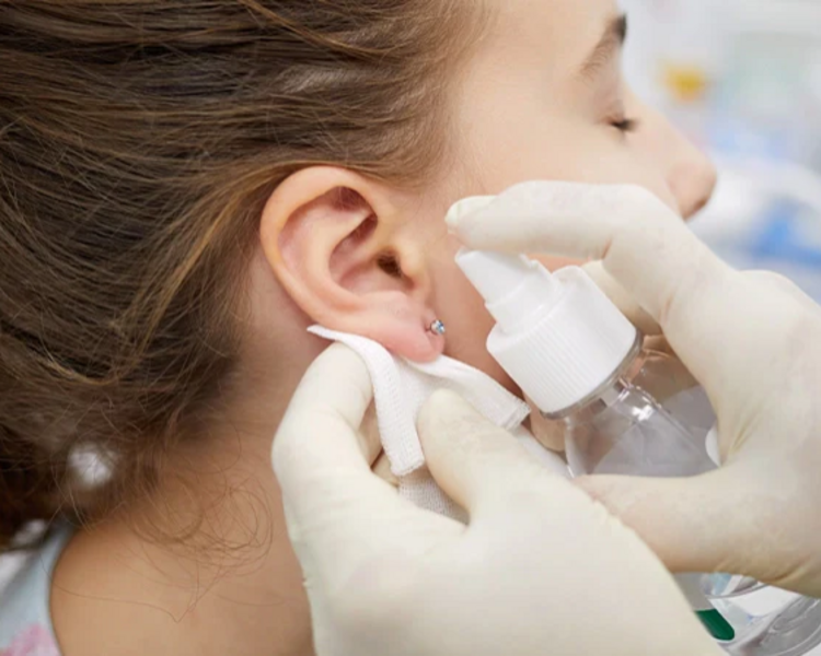 CURACION PIERCING POST 2 SEMANAS DE GARANTIA