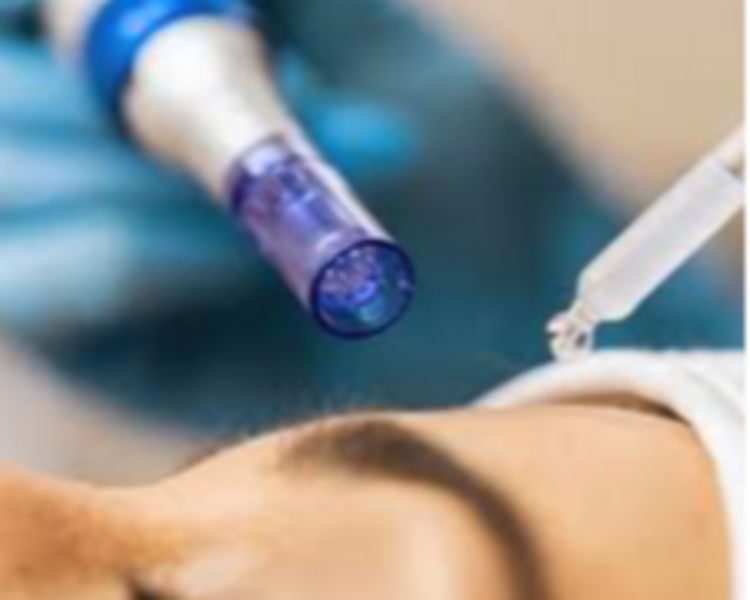 Limpieza Facial Hidratación #3