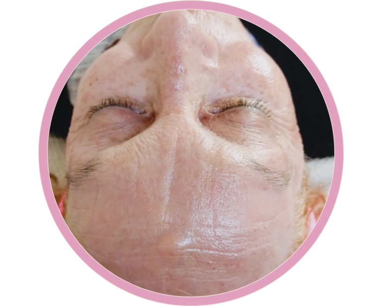 Facial Rejuvenece + Masaje faciales
