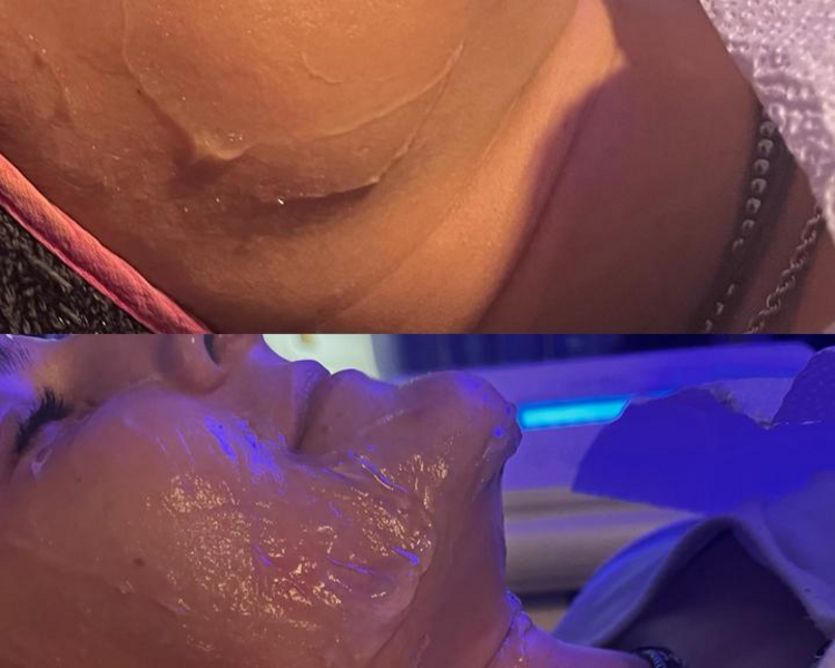 HIFU 12 PRO MAX FACIAL