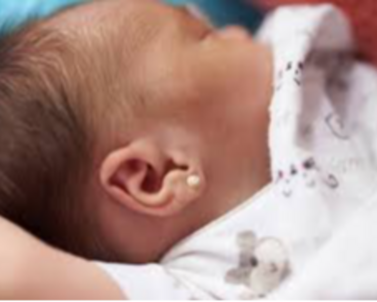 PERFORACIÓN PRIMEROS ARITOS RN (HASTA 2 MESES)