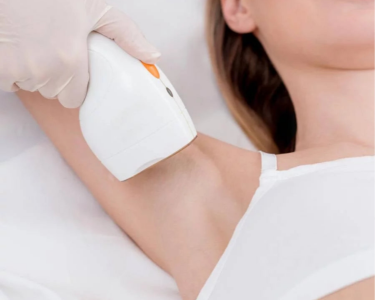 Depilación de Axilas