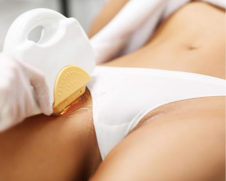 Depilación Rebaje Simple 