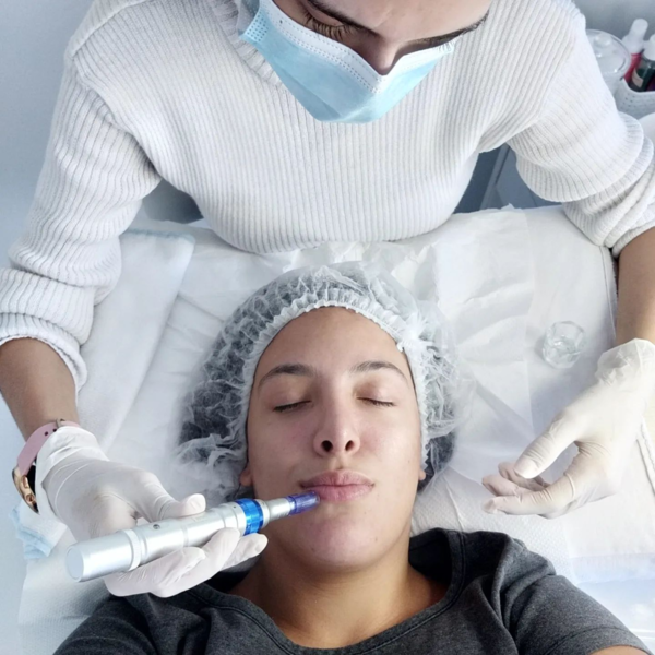 LIMPIEZA+MICRONEEDLING (DERMAPEN) (ROSTRO)