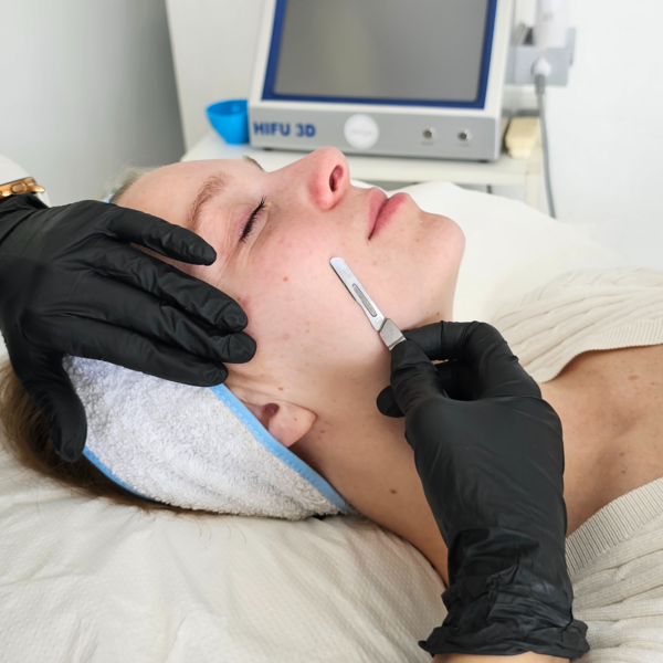 LIMPIEZA+DERMAPLANING+PEELING 