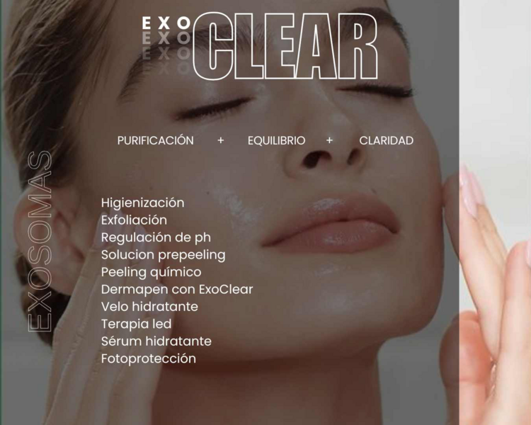 Exoclear 