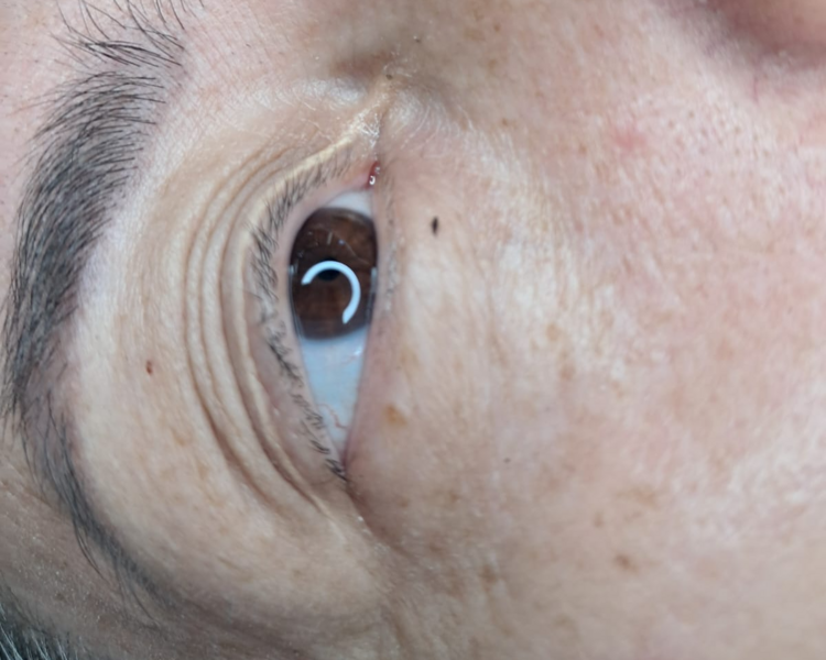 Micropigmentación de Ojos - Técnica Realce de Pestañas