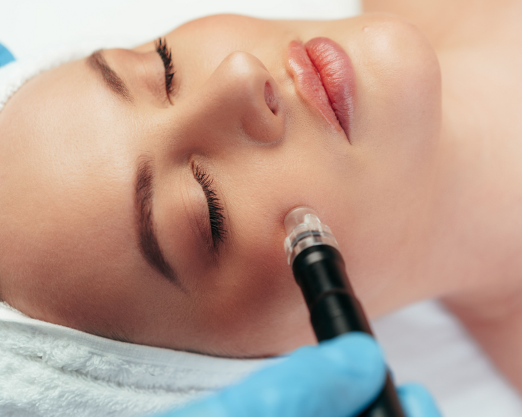 DERMAPEN DESPIGMENTACIÓN TR-XAMIC