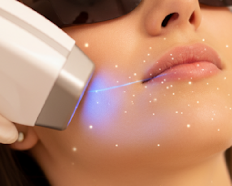 Diodo Rostro Medio 1 sesión