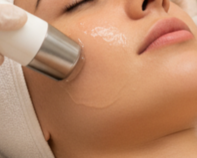 Ultrasonido Facial 1 sesión
