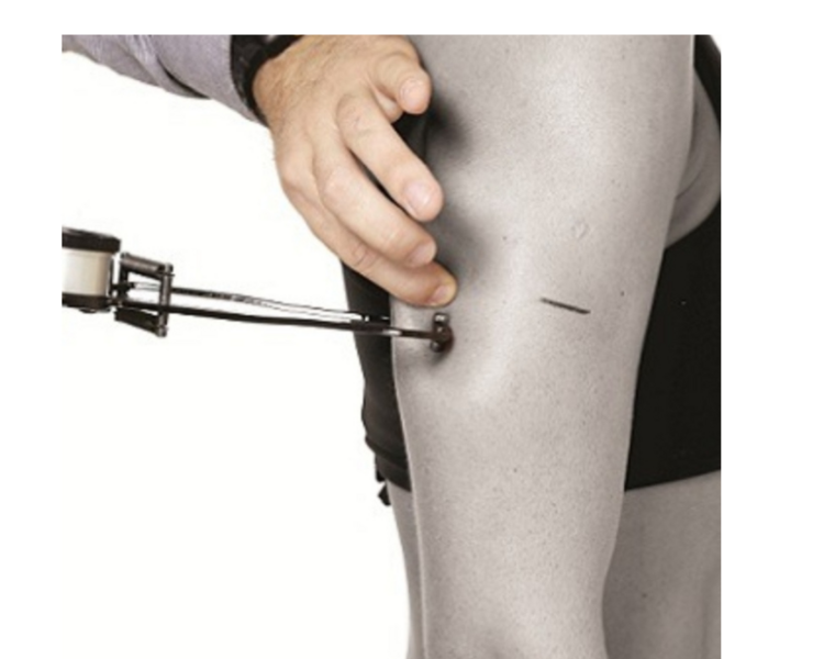 EVALUACIÓN NUTRICIONAL (PROTOCOLO ISAK 1)