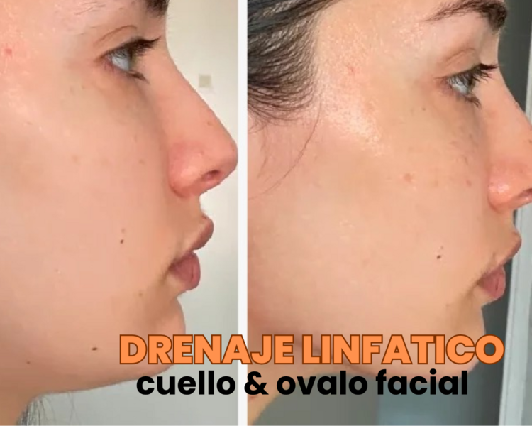 Quema Papada ( masaje de drenaje linfatico)