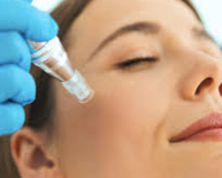 MESOTERAPIA NACIONAL