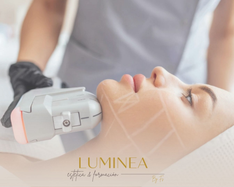 RF MICRONEEDLING + EXOSOMAS - Rostro completo + Cuello + Escote