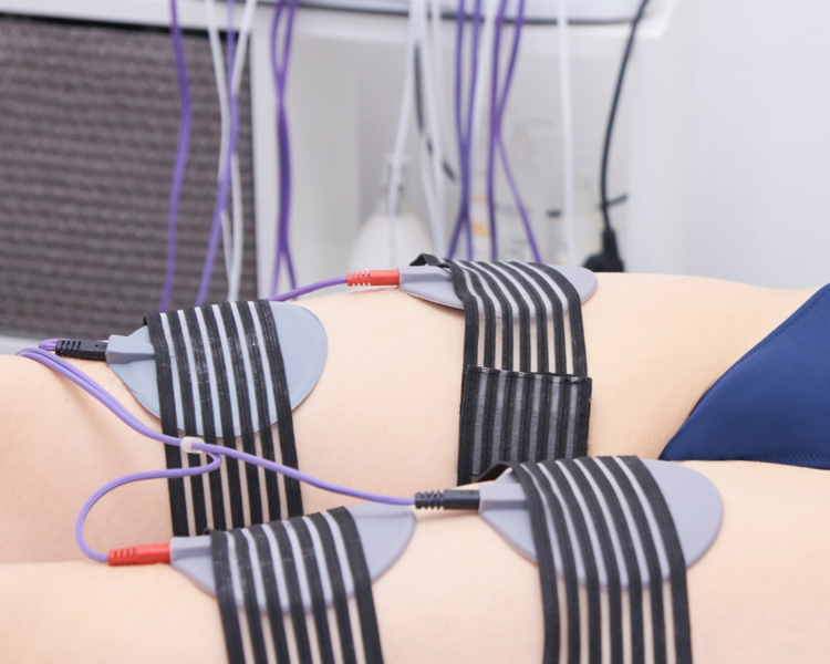 Electroestimulación